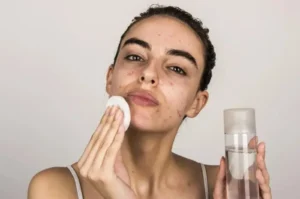 Acne Prone SkinCare Products